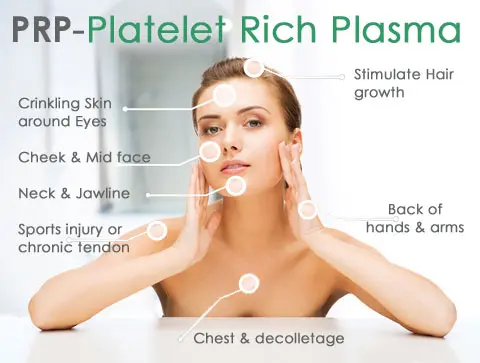 Graphic showing details of the Platelet Rich Plasma treatment