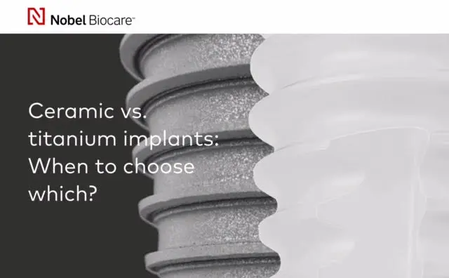 Ceramic dental implants VS titanium dental implants