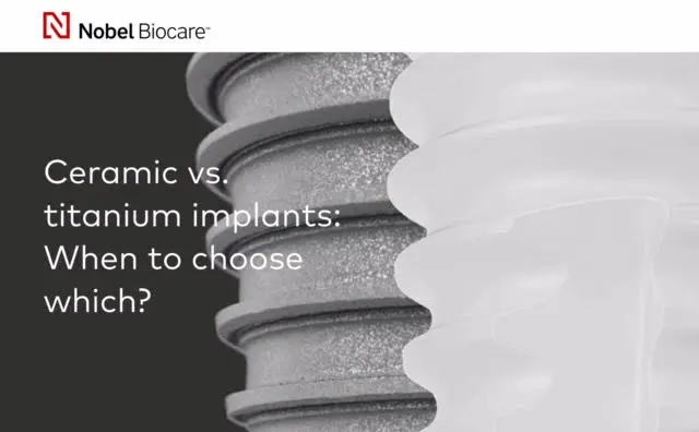 Implantes dentários de cerâmica VS implantes dentários de titânio