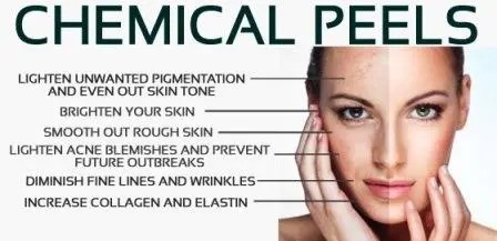 A graphic explaining the key aspects of chemical peels