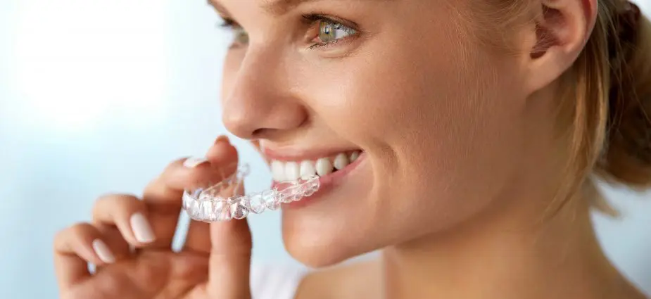 An image showing the clearcorrect clear braces