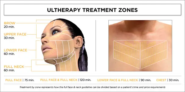 A graphic showing the ultherapy treatment zones